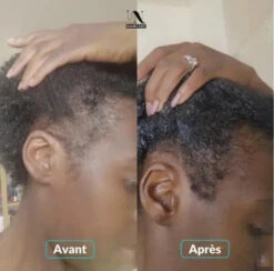 Gélules Pousse & Volume Cheveux Cure 1 Mois - In Haircare -Evolve Cosmetiques Inhaircare avant apres gelules cheveux cure 1 mois
