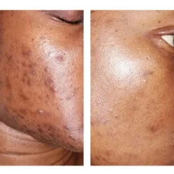 Mon Sérum Anti-taches - IN'OYA -Evolve Cosmetiques inoya efficacite Serum anti taches MEL OYA