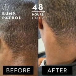 Après-Rasage Aftershave - Bump Patrol -Evolve Cosmetiques lotion apres rasage anti poils incarnes bump patrol bp2252 57 ml 675769