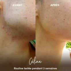 Masque Visage Purifiant En Poudre BIO - WAAM -Evolve Cosmetiques masque visage purifiant avant apres waam